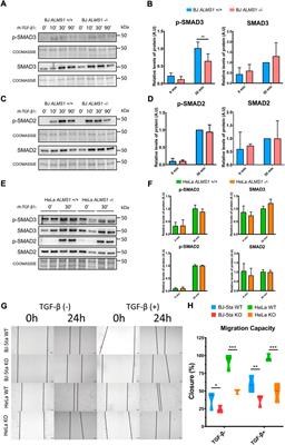 Depletion of ALMS1 affects TGF-β signalling pathway and downstream processes such as cell migration and adhesion capacity